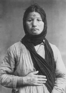 دختر ارمنی ترک شده و خال کوبی شده